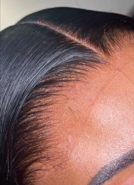 Lace Frontal vs Closure : Le comparatif complet